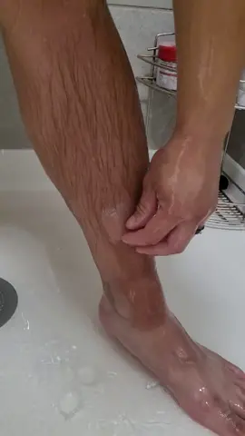 Weird things #sunburn #peeling #shower #water 