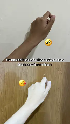 ขาวสมบูรณ์แบบ🥹❤️ #รีวิวบิวตี้ #ผิวขาวใสเร่งด่วน #ดูแลร่างกาย #fypシ #ใช้ดีบอกต่อ #รีวิวใช้ดีบอกต่อ #ป้ายยาสกินแคร์ #รีวิวบิวตี้ #รีวิวบิวตี้ในtiktok #tiktokuni #tiktokป้ายยา #tiktokครีเอเตอร์ #tiktokครีเอเตอร์🛒 #รีวิวของดีบอกต่อ #เธรดดูแลตัวเอง #เธรดดูแลผิว 