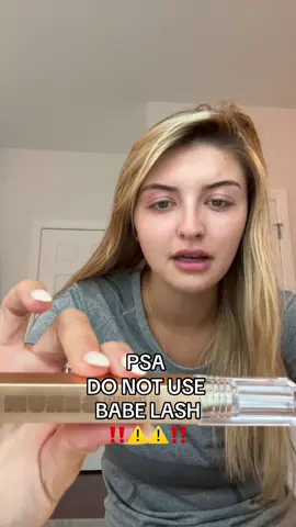 Have any of you guys experienced this?!😭😭😭 #babelashserum #babelashreview #babelash #babelashisbadforyou #sendhelp 