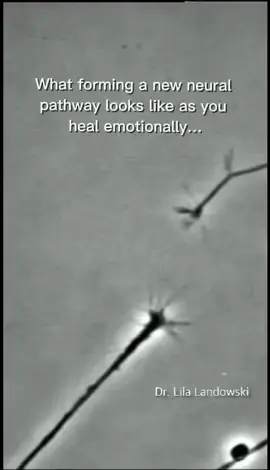How neurons connect in your brain when going through #emotional #healing #neuroscience 