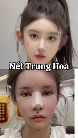 Sự xinh đẹp này… cho những bạn thích nét Trung. #muitrunghoa #chuyensuamuihong #muiphongthuy #drthong #doyinchina 