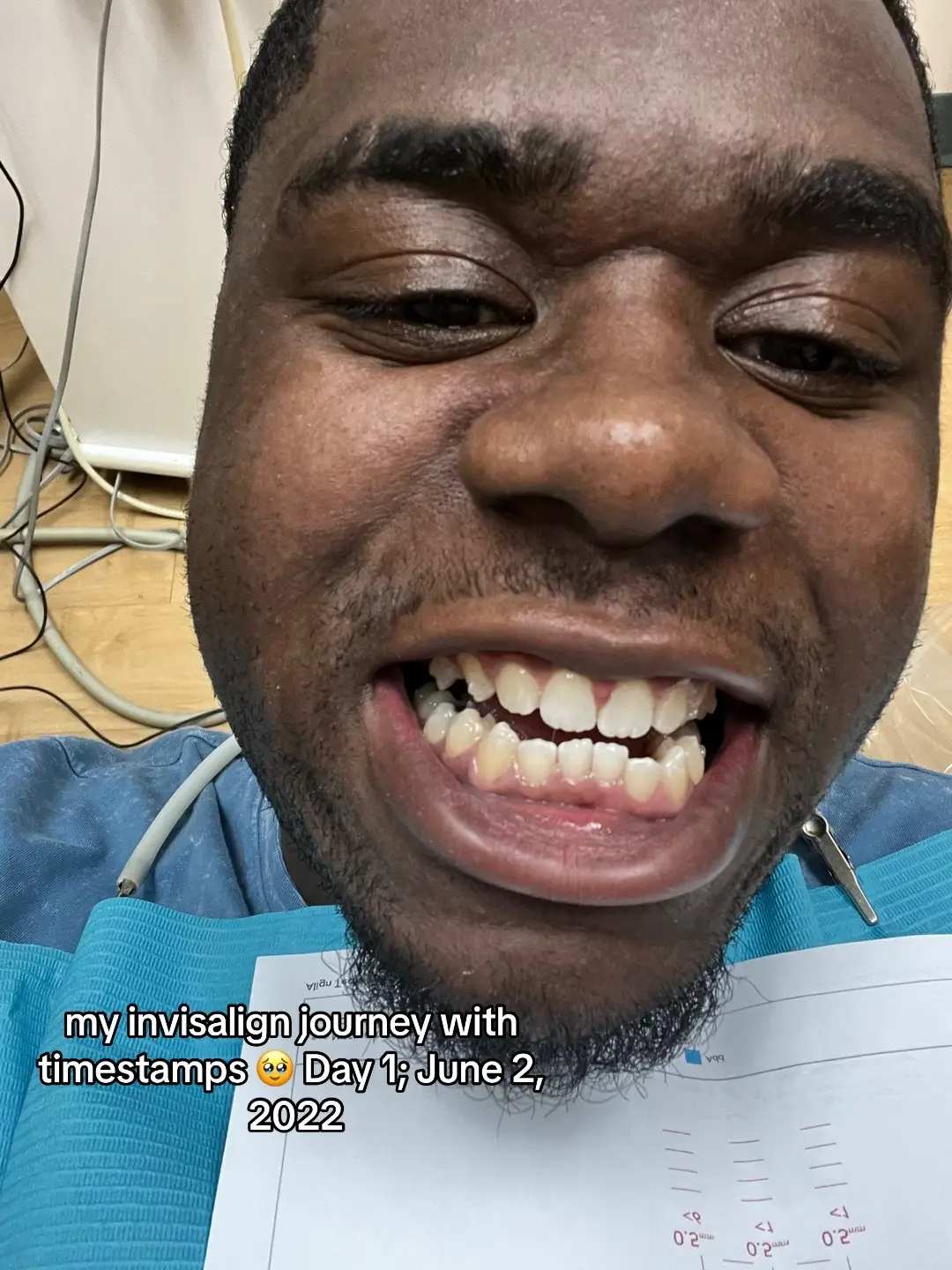 thank you @invisalign for giving me the confidence to smile again 🫶🏽  #invisalign #smilemakeover #personalhygiene #fypシ 