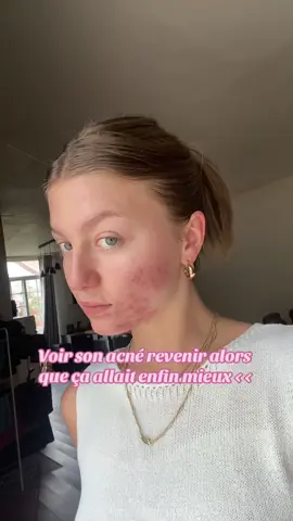 C’est dur de poster cette video… mais c’est ma peau. On dit merci aux regles et a ses hormones de m*rde  #SelfCare #acne #acnepositivity #acnescars #clearskin 