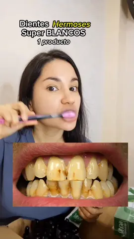 Dientes Super Blancos con #pastagreenwordherbs #pastahgw #dientesblancos #pastasinfluor 👄💞🫶 Lo haz probado ya?  Más info en perfil 