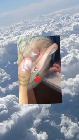 satisfying video cleaning #satisfying #satisfyingvideo #oddlysatisfying #satisfyingvideocleaning #jiggers #removal #clean #CleanTok #cleaning #tiktok #viral #trend #foryou 