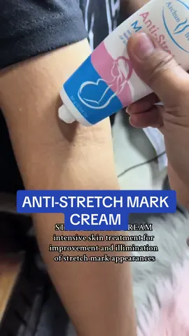 Hanap mo ba ng effective na cream for stretch marks?! baka eto na yung hinahanap mo.. CHECKout na sa yellow basket! ANTI STRETCH MARK CREAM by aichun beauty. BUY 1 TAKE 1 PA!!!! #tiktokshop #tiktokaffiliatemarketing #tiktokaffiliate #foryoupageofficiall #foryoupage #fypシ゚viral #nasayellowbasket☺️ #myshowcase 