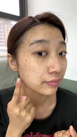 👍👏 For sensitive skin, take a look. This exfoliating ingredient is mild and does not irritate the skin. 👏🤩After use, the face is refreshing, silky and clean. Skin care products are better than absorption. 🥳✅It is more cost-effective to place an order for two now. #skincare  #exfoliation  #fyp  #bodyscrub  PH870