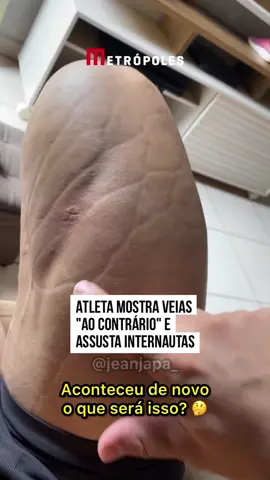 🏋️‍♀️ 😱 O #Bodybuilder Jean Japa deixou os internautas em choque ao mostrar um acontecimento no mínimo esquisito com suas #veias, que pareciam estar em modo 