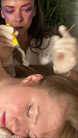 Asmr sharp or dull - strange scalp exam #asmr #asmrsounds #asmrsound #asmrsoundsdaily #asmrsoundsgirl #asmrsoundsontiktok #asmrvideo #asmrvideos #asmrvideosounds #asmrtiktoks #asmrtiktok #asmrtiktoks🦋asmr🦋 #asmrtiktokvideo #asmrtiktokvideos #asmrsoftspoken #softspokenasmr #asmrealperson #realpersonasmr #asmr_tingles #asmrscalp #asmrscalpcheck #asmrscalpmassage #asmrscalpexamination #asmrscalptingles #asmrhairbrushing #asmrhairplay #asmrhair #asmrhairsounds #asmrhaircare #asmrsensory #asmrsensations #asmrsensationtest #asmroddlysatisfying #oddlysatisfying #oddlysatisfyingvideo #oddlysatisfyingtiktok #oddlysatisfyingasmr #asmrmedical #asmrmedicalroleplay #asmrmedicalexam #asmrdoc #asmrdoctor #asmrdoctorroleplay #asmrdoctorexam #asmrtingle #asmrtingles #asmrtinglesvideos #tingle #tingles #tinglesounds #tinglesasmr #tingly #tinglyasmr #tinglysounds #asmrtrigger #asmrtriggers #asmrtriggerwords #asmrtriggersounds #triggerasmr #triggersasmr #asmrsleep #asmrsleepy #asmrsleeprelax #asmrsleeptriggers #asmrsleepandrelax #sleep #sleepy #sleepyday #sleeping #sleepingbeauty #sleepasmr #sleepyasmr #sleepasmrtriggers #asmrrrelax #asmrrelaxing #asmrrelajante #asmrrelaxingsounds #asmrrelaxingvideos #asmrrelaxingvideo #asmrrelaxante #asmrrelaxation #asmrrelaxandsleep #relax #relaxing #relaxvideos #relaxingvideos #relaxingvideosr #relaxingsounds #relaxingsound #relaxation #relaxationviibes #relaxingasmr #relaxingasmrsounds #relaxingasmrvideos #relaxante #relajante #relaxar #relaxtime #asmrtist #asmrtistsoftiktok #asmrtistyoutuber #asmrtists #asmrscratching @Caitlin 🌸 