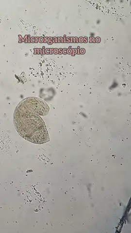 Microrganismos no microscópio #fyp #malicemizer #paris 