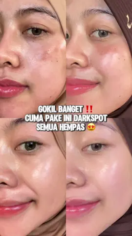 Hempas flek hitam pake symwhite 377✨ #darkspot #flekhitam #symwhite377 #moisturizer 