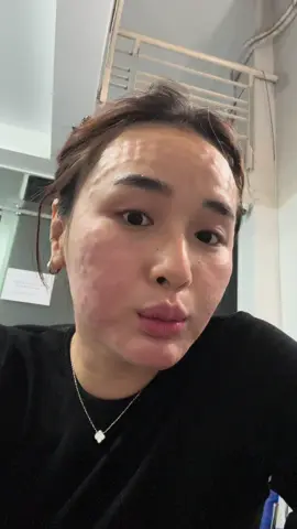 Tất cả đều quay bằng cam thường cho mọi người thấy sự thay đổi nha#quynhnhie #tiemmeso 