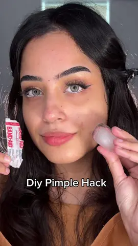 Diy pimple patch which will reduce redness in just 20 minutes😍 #explore #skincare 