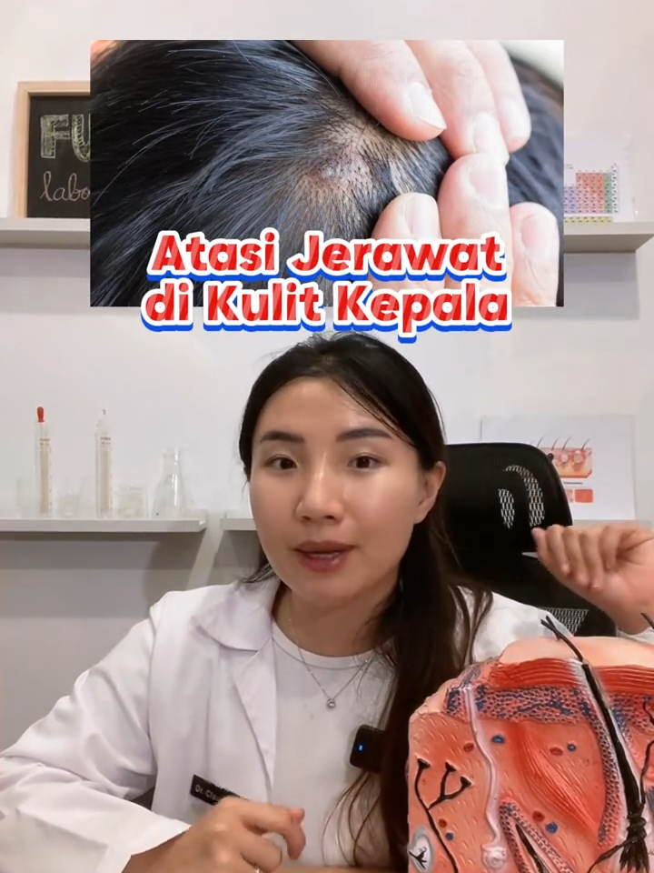 benjolan di kulit kepala yang menyerupai jerawat? hmm gimana ya cara atasinya? #funskincare #jerawat #scalp