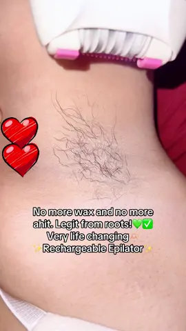 NO MORE WAX & NO MORE AHIT!✅ From Roots!🍀 NOT AHIT💚 Buyhere ##epilator #underarmhairremoval #keda #fypシ゚viral #viral #fyp #fypシ #trendingtiktok #fyppppppppppp #trending #fypage #trendingsound 