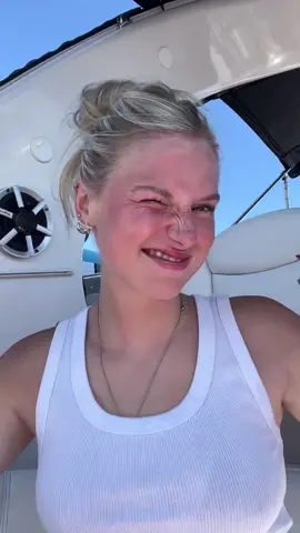 sunBURNT ☀️ #fyp #Summer 