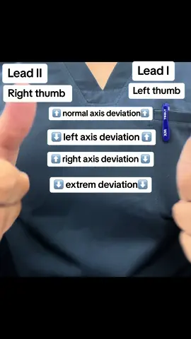 كيف تعرف تحدد ال axis deviation في تخطيط القلب  #nurse #nursing #nursesoftiktok #nursingstudent #nursingschool #cardiacnurse #ccunurses #التمريض #تمريض #ecg 
