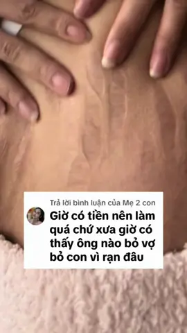 Mấy người cơ địa không rạn sao mà hiểu được nỗi khổ của phụ nữ mang bầu và sau sinh tụi tui #phunu #mebau #lamme #xuhuong #fypシ #randa 