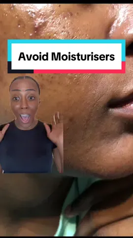 Moisturiser for oily skin? Absolutely!! Don’t believe the misconception 💦 #creatorsearchinsights #moisturizer #oilypores #moisturizercream 