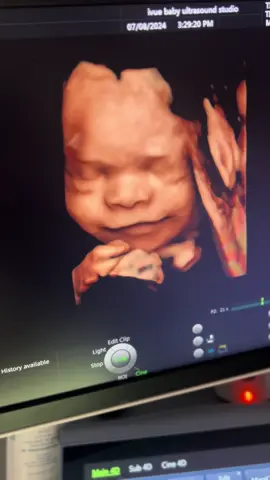 #hi #hey #waves #babycute #tiny #little #ultrasound #pregnancy #pregnancyannouncement #pregnancylife #pregnancyjourney #pregnantbelly #pregnantlife #momtobe #dadlife #parenthood #newparents #firsttimeparents #28weeks #28weekspregnant #firsttrimester #secondtrimester #thirdtrimester  #fyp #viral #fypシ #fypage #fyppppppppppppppppppppppp #fypシ゚viral #fyppp #viraliza #viralvideotiktok #viralllllll #virale #viralchallenge #cute #cutebaby #5d #ultrasound #studio #southflorida 