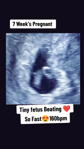 7 Weeks pregnant #7weeks #7weekspregnant #7weeksold #7weeksand3days #pregnanttiktok #pregnancyjourney #pregnant🤰 #viraltiktok #viralvideo #draneelaofficial 