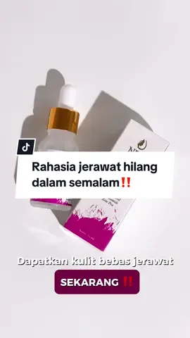 Serum yang kamu cari pastinya Acne Serum NBS karena apa? karena acne serum adalah solusi muka kamu yang lagi breakout✨ #NBSofficialstore #NBSSkincare #skincareviral #fyp 
