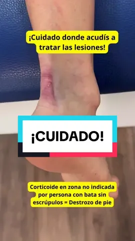 ⚠️¡Cuidado donde acudís a tratar las lesiones del pie! ⚠️Infiltración de Corticoide en zona no indicada por persona con bata blanca = destrozo de pie. #destrozo #aquiles #tendondeaquiles #tendon #biomecánica #ejercicios
