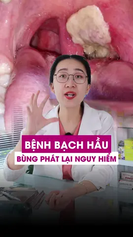 Nguy hiểm của bệnh bạch hầu #dsnhidong #benhbachhau #LearnOnTikTok #ydgr 