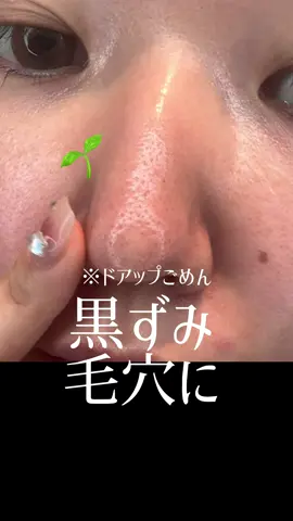 【毛穴検証】１ヶ月ガチで検証するために、毛穴を作り上げました。 効果なかったら許せません(笑)結果はいかに･･･ #PR #ダヴ #炭ジェル #毛穴ケア #洗顔 #毛穴の黒ずみ #美容 