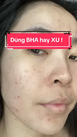 Lý do tui ít review các loại BHA đặc trưng !  #goclamdep #beautytips #BeautyReview #beauty #skincare #acne #Ahohwa #BHA #TonerBHA #mụn 
