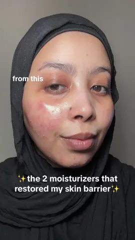 korean moisturizers that restored my skin barrier  #koreanmoisturizer #skinbarrier #skinbarrierrepair #soonjung2xbarriercream #madagascarcentella #skin1004 #skin #skintok #nofilter #realskin #fyp 