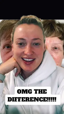 I cannot get enough of this product!!!  #dermaeye #byeeyebags #aesthetics #beauty #freshface #berko 