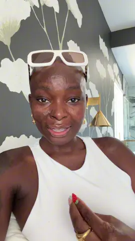 I don't expect anyone to know my name, but I'm also not accepting “The Burned Face Girl.” It takes a few seconds to be mindful of how you can make someone feel with your words. I have gotten excellent at not allowing things to get to me, but this definitely struck a nerve for some reason. Let's do better 💔