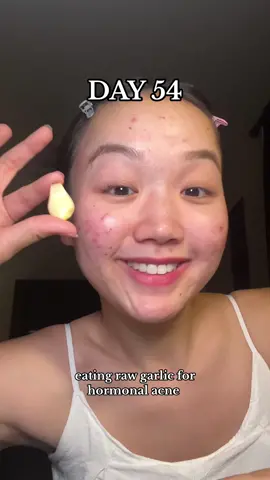 6 more days 🥹  #fyp #viral #relateable #acne #hormonalacne #acnetreatment #garlic #acnejourney #clearskin 