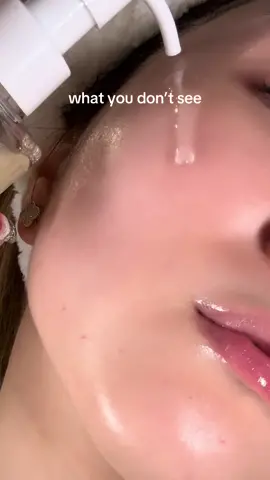 👀up close and personal 😵  Using ANUA Cleansing Oil & SKIN1004 Poremizing Quick Clay Stick Mask #anua #skin1004 #kbeauty #koreanskincare #glassskin #glowyskin 