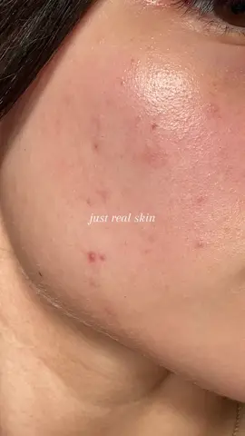 Nuestro cuerpo es el lugar donde habita el alma que muchas personas aman, del alma por la cual deberíamos sentir un amor inmenso, cada marca y cicatriz en nuestra piel solo es un reflejo de nuestra humanidad, sé que muchas pieles se ven distintas a la mía, pero eso no disminuye ni aumenta el amor que siento por ella. Solo espero que si tenemos el privilegio de envejecer, no miremos al pasado y nos demos cuenta que pasamos años odiando el cuerpo en el que habitamos. 🤍 #realskin 