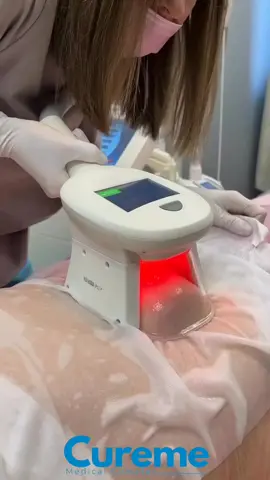 Cryolipolysis: Freeze Away Unwanted Fat! Say goodbye to stubborn fat pockets with our Cryolipolysis treatment! This revolutionary procedure uses low temperatures to destroy fat cells without damaging surrounding tissues. Our state-of-the-art machine cools specific areas of the body to a temperature that triggers fat cell death, resulting in a significant reduction in fat deposits. Book your appointment now and enjoy a slimmer, more toned you! 🤍 Results may vary depending on individual body characteristics, number of treated areas, and a healthy lifestyle after the procedure. #Cryolipolysis #FatFreeze #Fat Reduction #BodyContouring #NonInvasive #WeightLoss #BodySculpting #FatRemoval #SlimmingTreatment #CosmeticProcedure #BeautyTreatment #Wellness #HealthAndBeauty #GetSlim #TransformYourBody #Laser #AcneScar #SkinSpots #HairTransplant #Beauty #Filler #Rejuvenation #SkinCare #EyebrowTransplant #Aesthetics #AntiAging #Botox #ChemicalPeel #CoolSculpting #DermalFillers #FacialRejuvenation #HairRemoval #LaserHairRemoval #LaserSkinTreatments #MedicalSpa #Microdermabrasion #Microneedling #NonSurgical #PlasticSurgery #RadioFrequency #SkinTightening #WrinkleReduction #YouthfulSkin #BeautyClinic #CosmeticDermatology #SkinHealth #AestheticMedicine #BodyContouring #FaceLift #Injectables #LaserResurfacing #SkinRejuvenation #cureme #curememedicalcomplex 