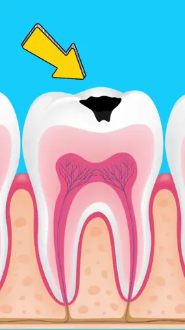 Làm thế nào để bảo vệ răng miệng cho trẻ giai đoạn sớm?  #theci #thecivietnam #xitrangmiengtheci  