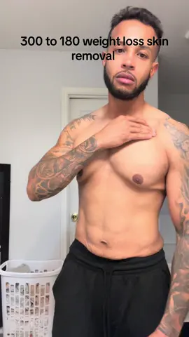 Surgery went great tien to get ready for the cruise lol 😆 #gynocomastia #foryoupage #fyp #viral 