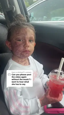 Replying to @mbishop37 ❤️🍀 - I am sooo proud at how she ALWAYS tells me after every surgery how brave she is, to acknowledge that at 5 years old is simply amazing ❤️ - absolutely so brave my baby ✨ #brave #acknowledge #braveness #awe #inawe #lasertreatment #surgery #tiktok #uk #fyp #fyppppppppppppppppppppppp #fypp #foryourpages #foryourpage #foryourepage #mygirlfriendisanalien #inspiring #confidence #birthmark #costa #bubbletea #yum #tired #mum #daughter #viralvideo #trend #loveyou 