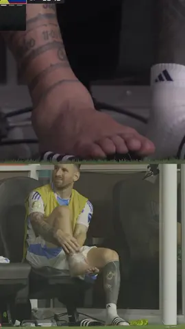 Messi se le hincho el tobillo 
