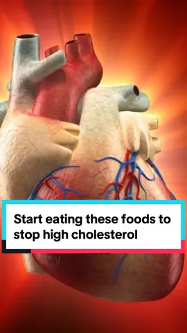 Start eating these food to fight high cholesterol naturally ☘️ #health #healthtips #healthy #healthyliving #healthylifestyle #wellness #tiktok #cholesterol #foryou #fyp 