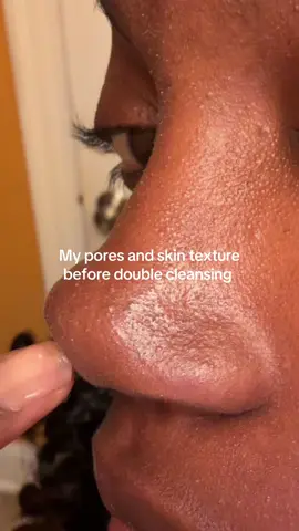 Korean skincare does it best!!my absolute favorite cleansers #doublecleansing #whiteheads #texturedskin #koreanskincare 