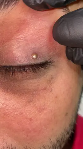 #trend_barbershop #skincare #تنضيف_بشره #رؤوس_سوداء 