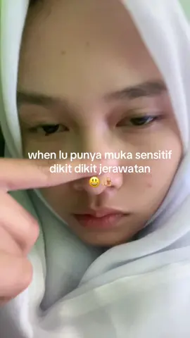 capee dede #fyp#viral#cape#acne#lewatberanda#foryou#4u 