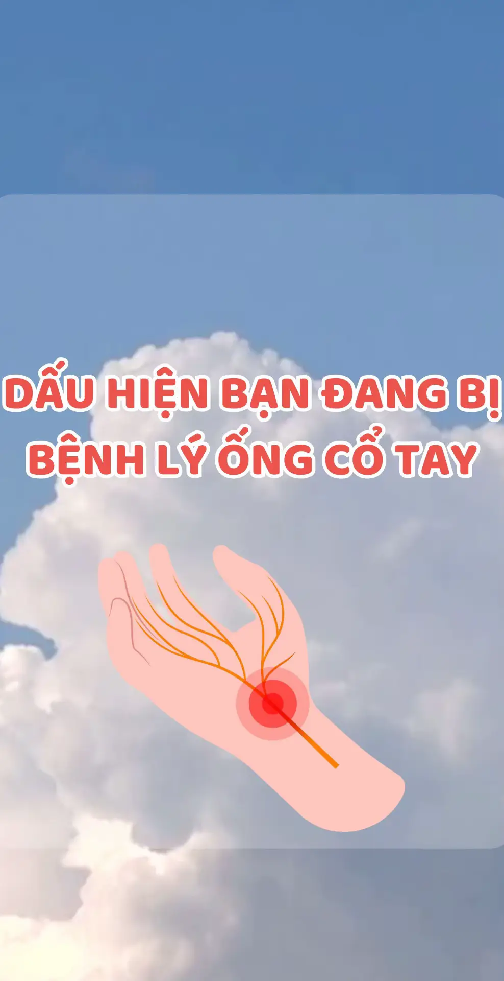 Dấu hiệu bệnh lý ống cổ tay #ongcotay #coxuongkhop #sirenhealth 