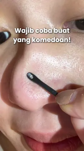 Wajib cobain buat yang komedoan! #blackheadsremoval #focalskin #focalskincare @FOCALSKIN Indonesia 