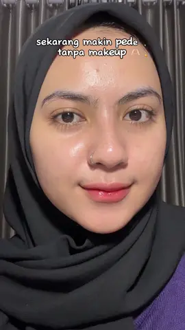 Sekarang aku udah pede banget keluar rumah tanpa complexion, karena sering pake serangkaian skincare dari @anieskin_id 😍🫶🏻✨  #BeraniTampilTanpaMakeUp #BeTheCenterOfAttention