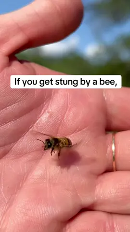 What to do if you get stung by a bee