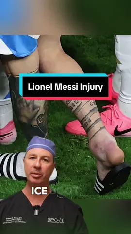 Ouch! A Twisted Ankle: This image shows Lionel Messi's ankle after he suffered a twist during the Copa America final. A twisted ankle happens when the ligaments that connect the bones in your ankle stretch or tear beyond their normal range. This can be caused by rolling your ankle inward or outward. Spotting a Twisted Ankle: Symptoms of a twisted ankle include swelling, pain, bruising, and difficulty walking. In the picture, we can see significant swelling around Messi's ankle, which is a telltale sign of a twist. On the Sidelines: Because of the swelling and potential ligament damage, Messi will likely need to rest and recover for a while. The severity of a sprain will determine how long it takes to heal, but some sprains can take weeks or even months to fully recover. #twistedankle #ankleinjury #anklepain #lionelmessi #lionelmessiinjury #orthopedicsurgeon 